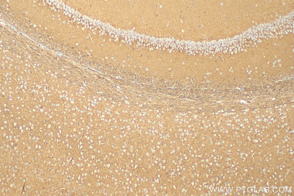 Immunohistochemistry (IHC) staining of mouse brain tissue using SEPT4 Recombinant antibody (82284-1-RR)