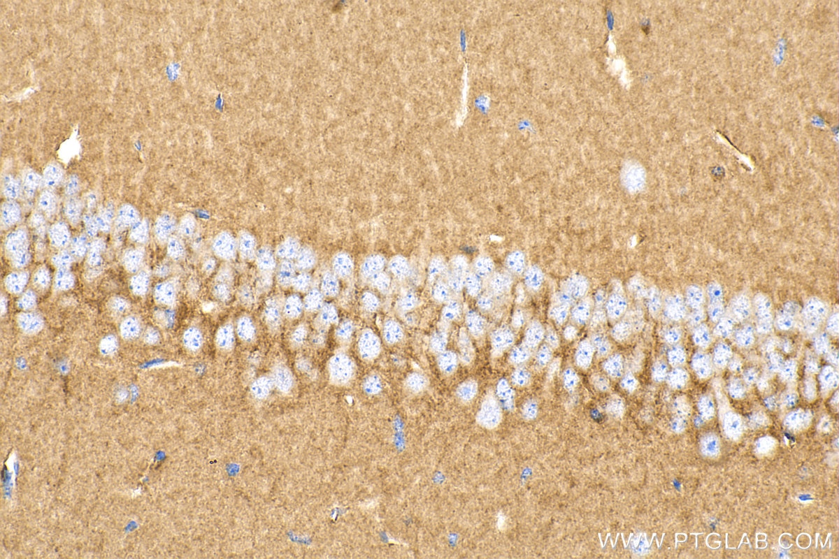 Immunohistochemistry (IHC) staining of mouse brain tissue using SEPT4 Recombinant antibody (82284-1-RR)