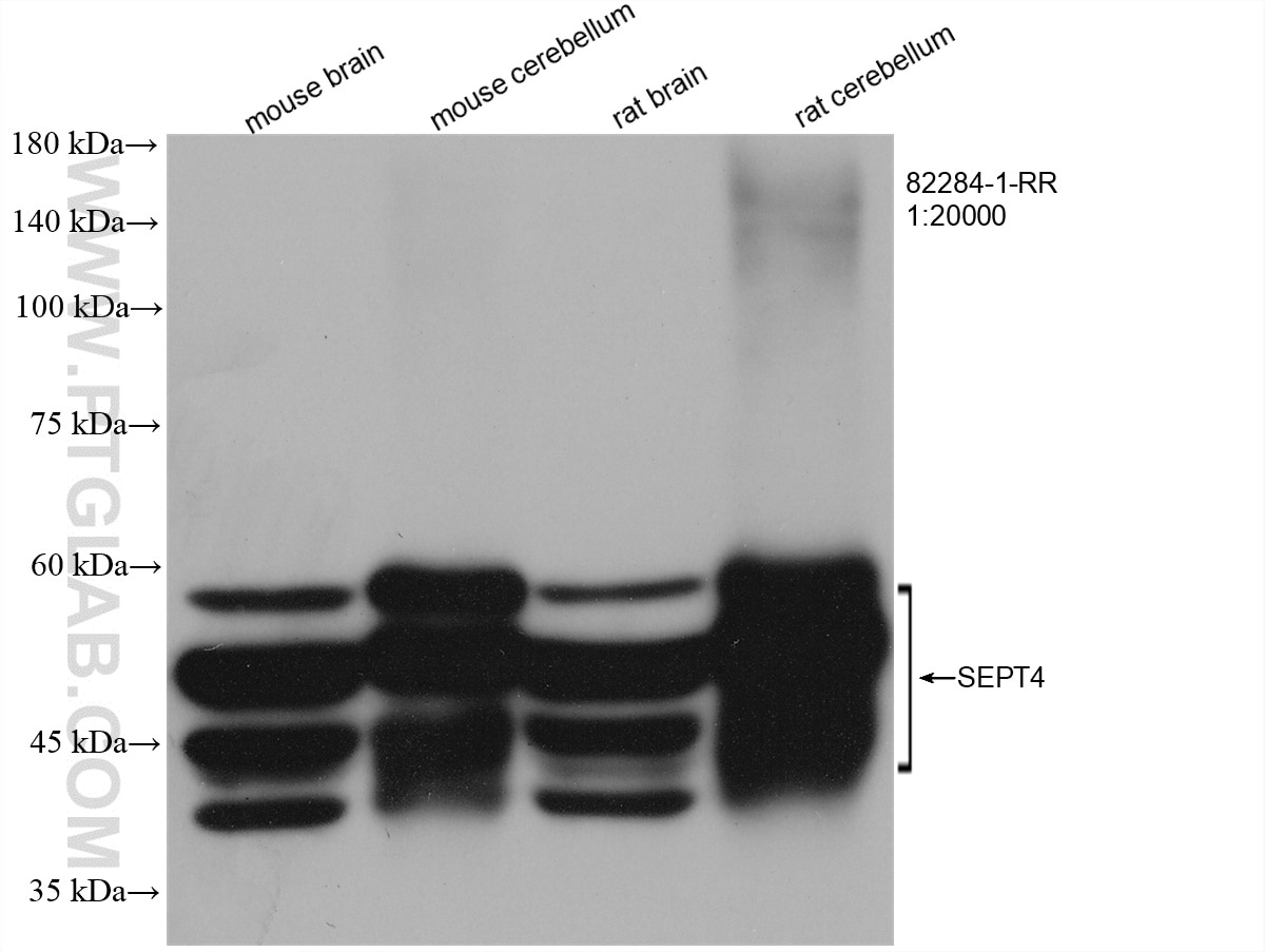 Western Blot (WB) analysis of various lysates using SEPT4 Recombinant antibody (82284-1-RR)