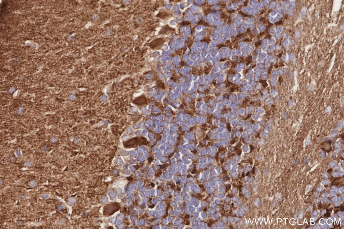 IHC staining of mouse cerebellum using 11631-1-AP Immunohistochemistry (IHC) staining of mouse cerebellum tissue using Septin 5 Polyclonal antibody (11631-1-AP)