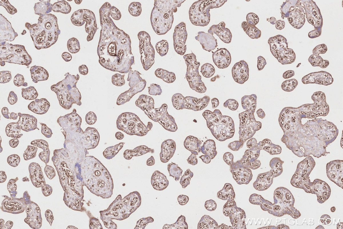 IHC staining of human placenta using 11631-1-AP Immunohistochemistry (IHC) staining of human placenta tissue using Septin 5 Polyclonal antibody (11631-1-AP)