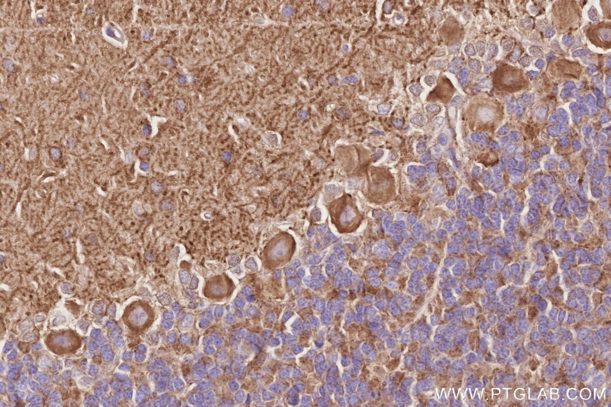IHC staining of rat cerebellum using 11631-1-AP Immunohistochemistry (IHC) staining of rat cerebellum tissue using Septin 5 Polyclonal antibody (11631-1-AP)