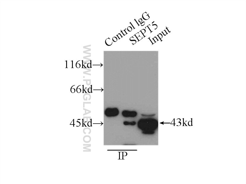 Immunoprecipitation (IP) experiment of mouse brain tissue using Septin 5 Polyclonal antibody (11631-1-AP)