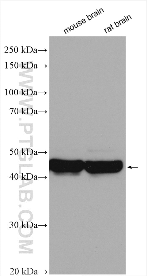 Western Blot (WB) analysis of various lysates using Septin 5 Polyclonal antibody (11631-1-AP)