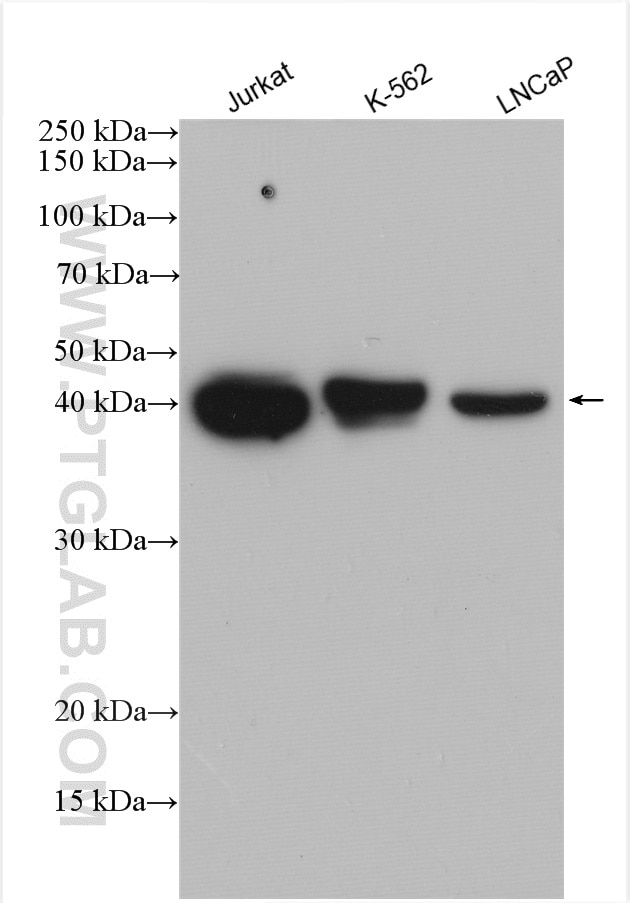 Western Blot (WB) analysis of Jurkat cells using Septin 5 Polyclonal antibody (11631-1-AP)