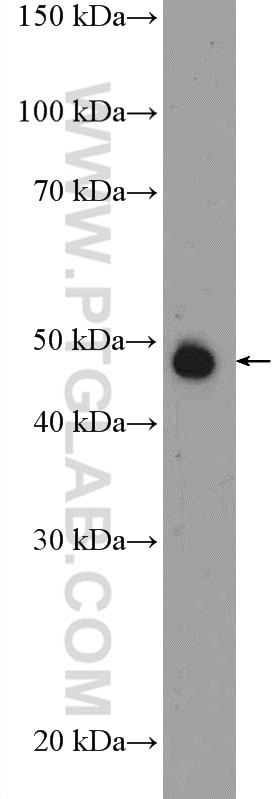Western Blot (WB) analysis of NIH/3T3 cells using Septin 5 Polyclonal antibody (11631-1-AP)