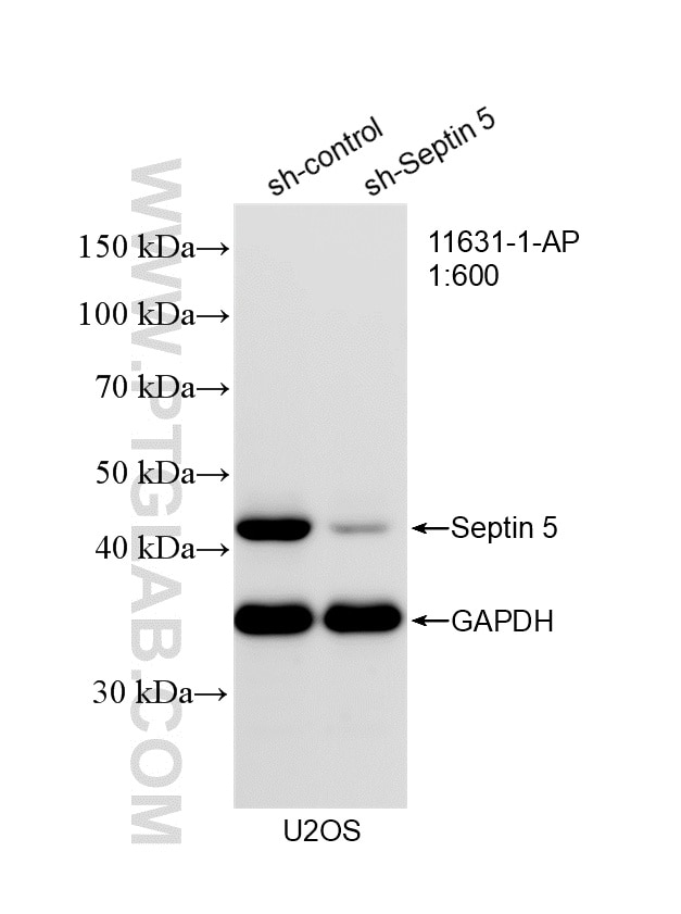 WB analysis of U2OS using 11631-1-AP Western Blot (WB) analysis of U2OS cells using Septin 5 Polyclonal antibody (11631-1-AP)