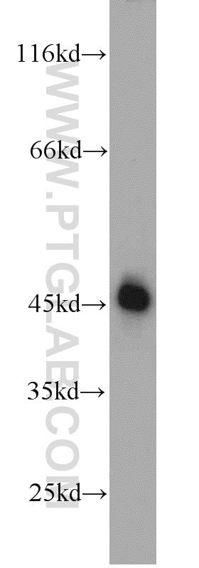 Western Blot (WB) analysis of human brain tissue using Septin 5 Polyclonal antibody (11631-1-AP)