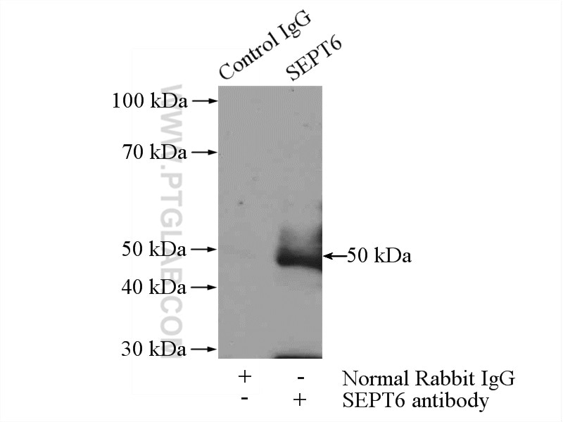 Immunoprecipitation (IP) experiment of rat brain tissue using Septin 6 Polyclonal antibody (12805-1-AP)