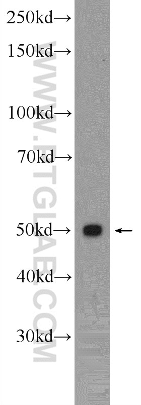 Western Blot (WB) analysis of Jurkat cells using Septin 6 Polyclonal antibody (12805-1-AP)