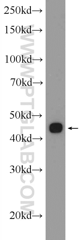 Western Blot (WB) analysis of K-562 cells using Septin 6 Polyclonal antibody (12805-1-AP)