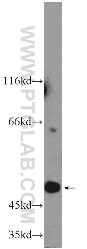 Western Blot (WB) analysis of rat brain tissue using Septin 6 Polyclonal antibody (12805-1-AP)