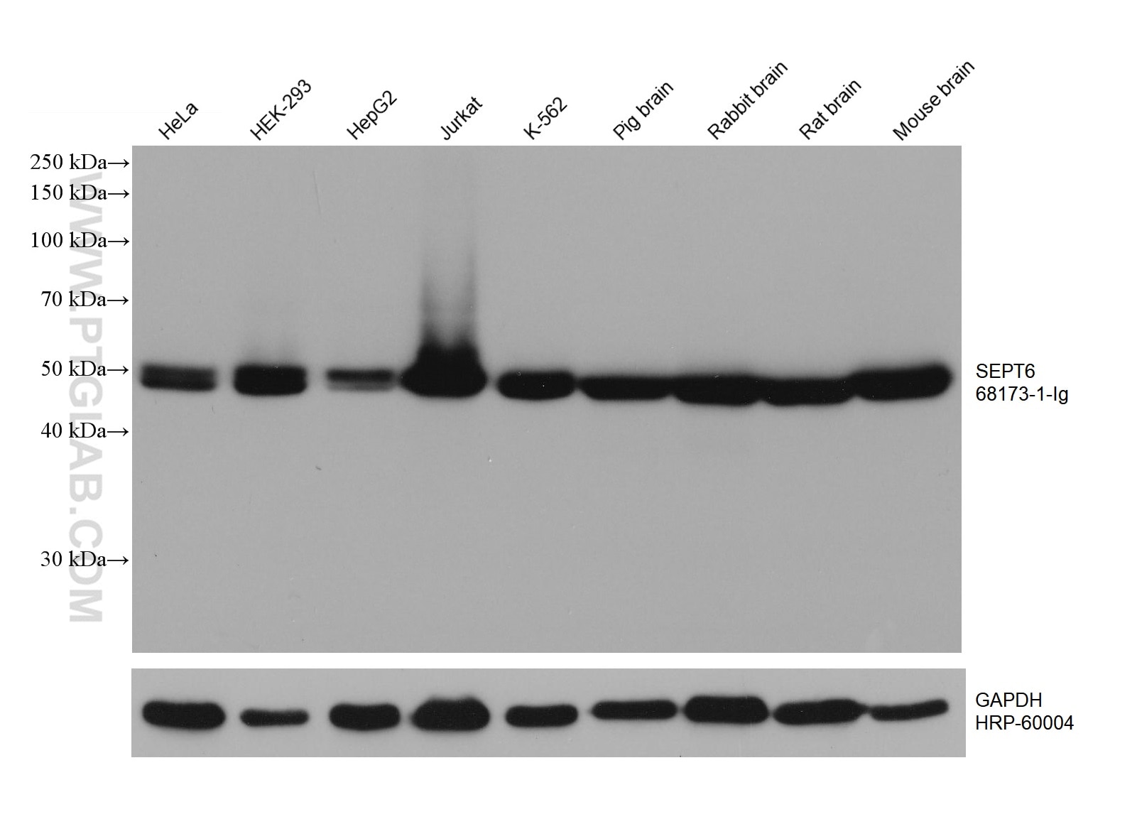 Western Blot (WB) analysis of various lysates using SEPT6 Monoclonal antibody (68173-1-Ig)