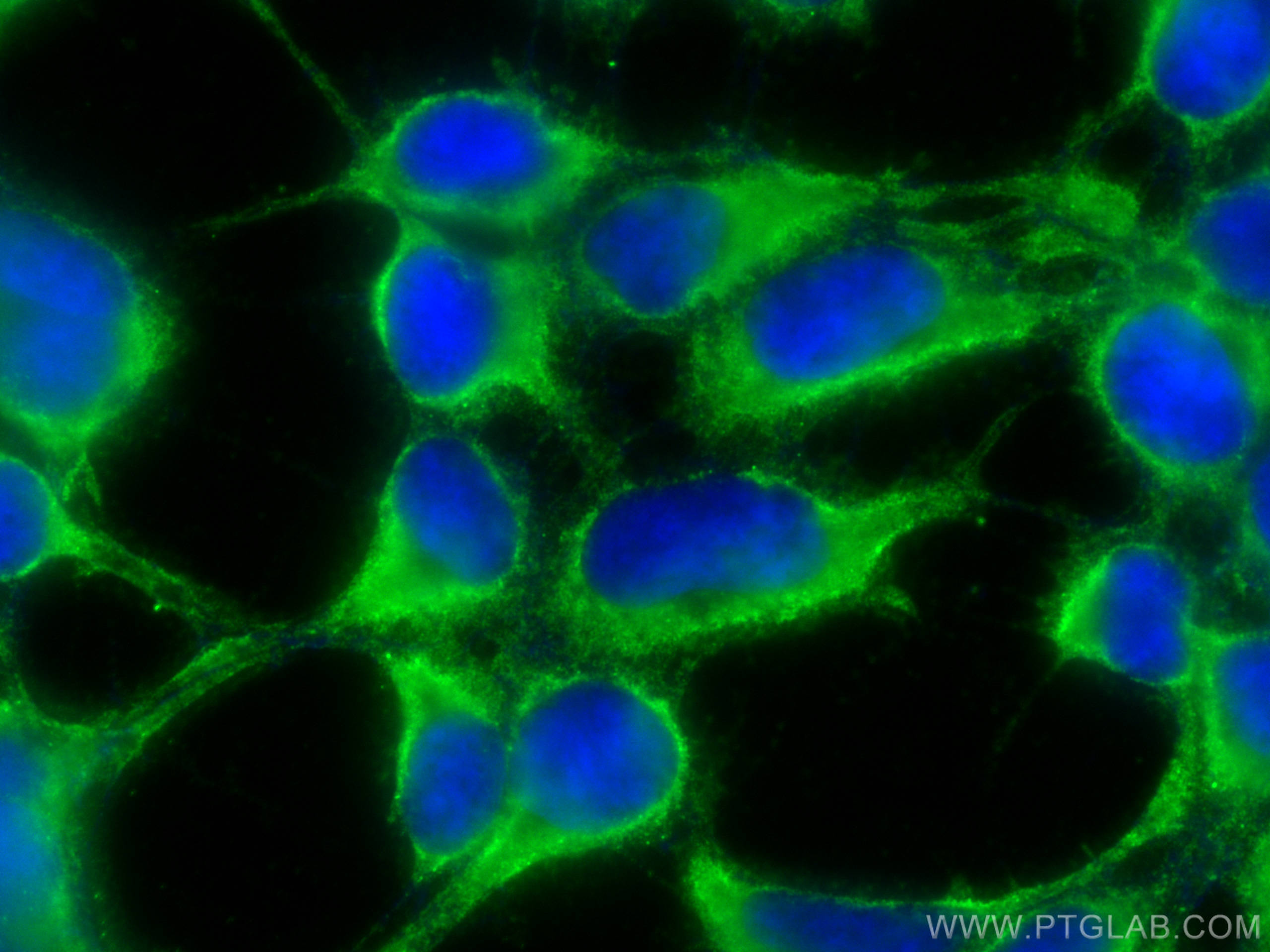 Immunofluorescence (IF) / fluorescent staining of HEK-293 cells using CoraLite® Plus 488-conjugated SEPT6 Monoclonal ant (CL488-68173)