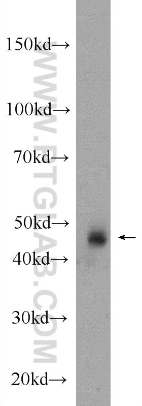Western Blot (WB) analysis of rat testis tissue using Septin 7 Polyclonal antibody (13818-1-AP)