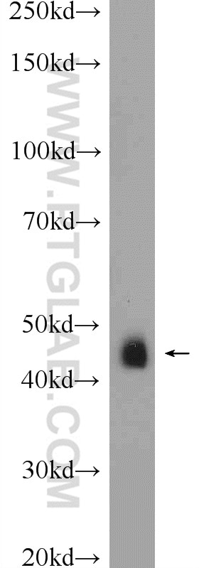 Western Blot (WB) analysis of mouse testis tissue using Septin 7 Polyclonal antibody (13818-1-AP)