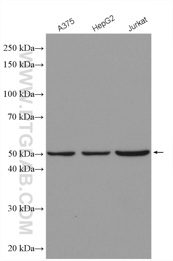 Western Blot (WB) analysis of various lysates using Septin 7 Polyclonal antibody (13818-1-AP)