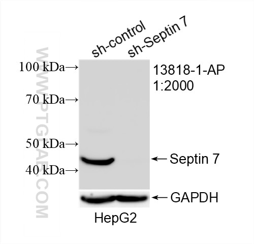 Western Blot (WB) analysis of HepG2 cells using Septin 7 Polyclonal antibody (13818-1-AP)