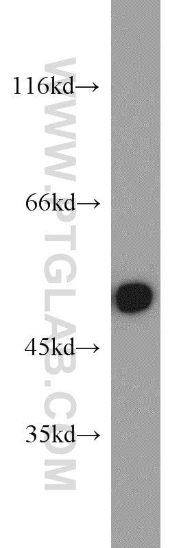 Western Blot (WB) analysis of A375 cells using Septin 7 Polyclonal antibody (13818-1-AP)