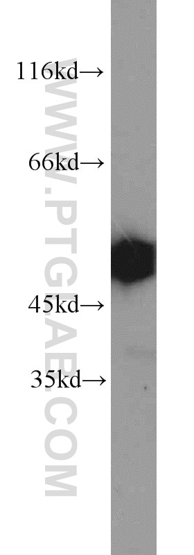 Western Blot (WB) analysis of HeLa cells using Septin 7 Polyclonal antibody (13818-1-AP)