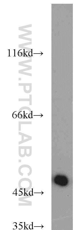 Western Blot (WB) analysis of Jurkat cells using Septin 7 Polyclonal antibody (13818-1-AP)