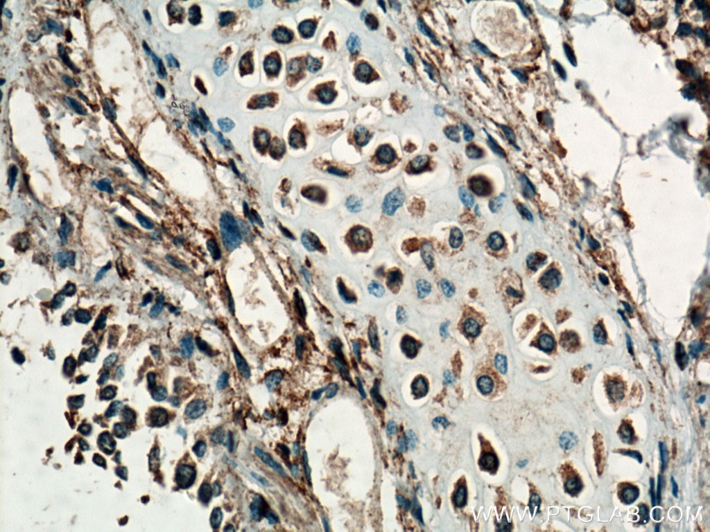 Immunohistochemistry (IHC) staining of human lung tissue using Septin 7 Monoclonal antibody (66542-1-Ig)