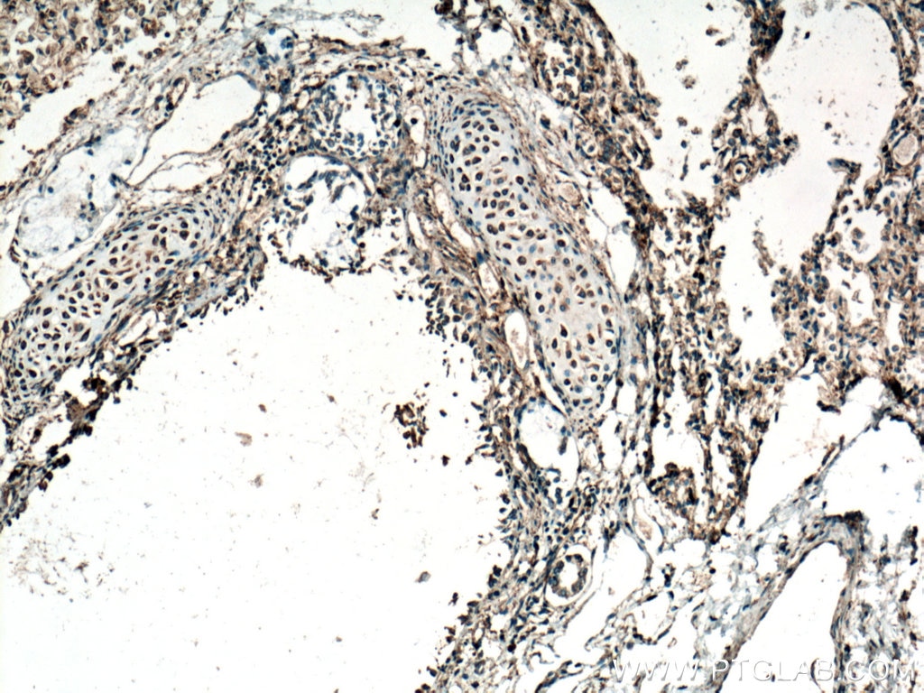 Immunohistochemistry (IHC) staining of human lung tissue using Septin 7 Monoclonal antibody (66542-1-Ig)