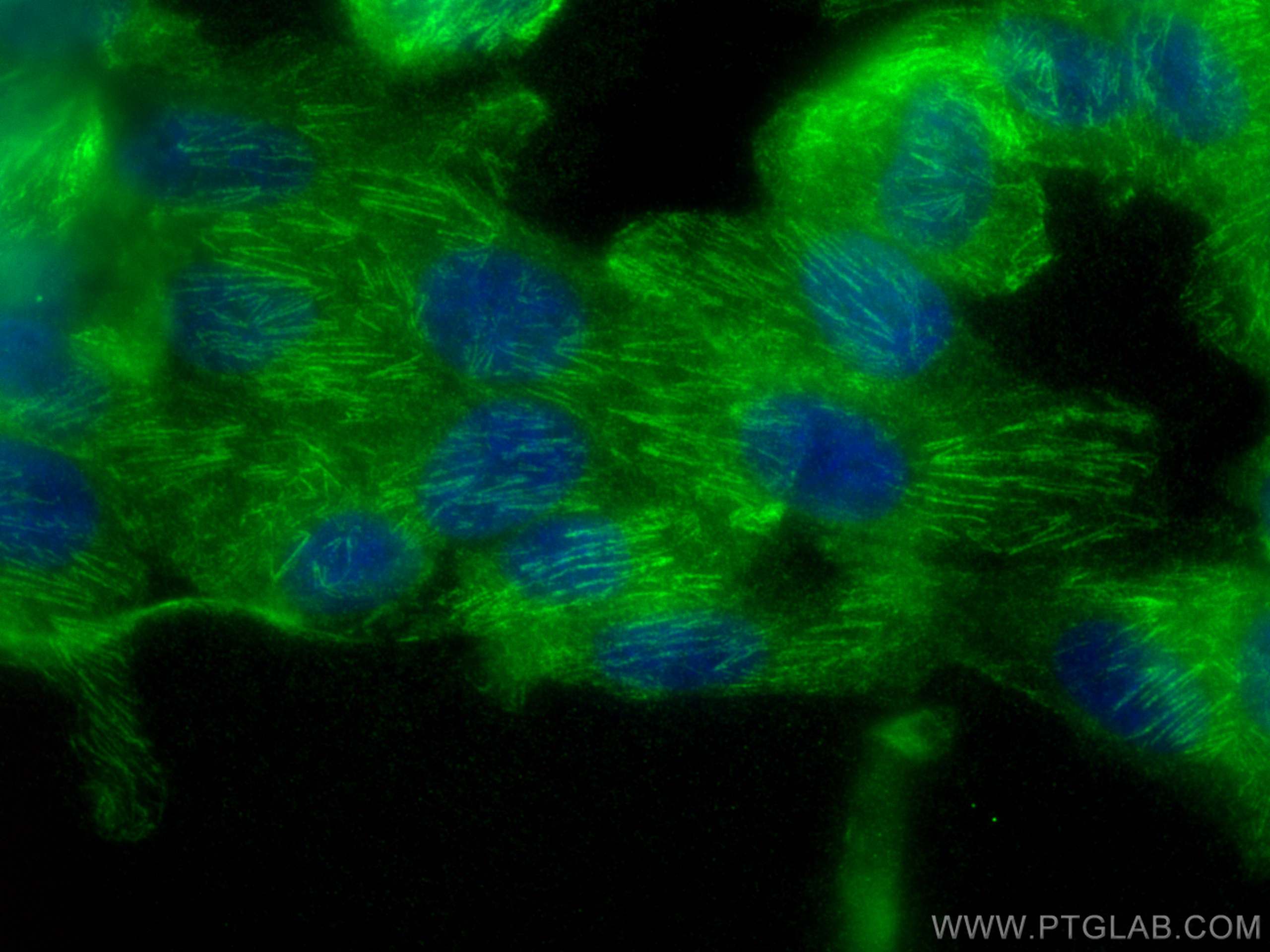 Immunofluorescence (IF) / fluorescent staining of hTERT-RPE1 cells using Septin 8 Polyclonal antibody (11769-1-AP)