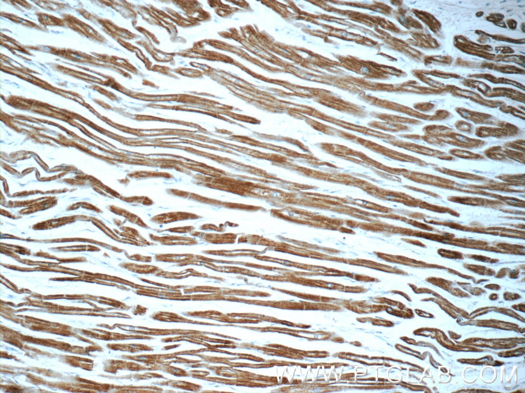Immunohistochemistry (IHC) staining of human heart tissue using Septin 8 Polyclonal antibody (11769-1-AP)
