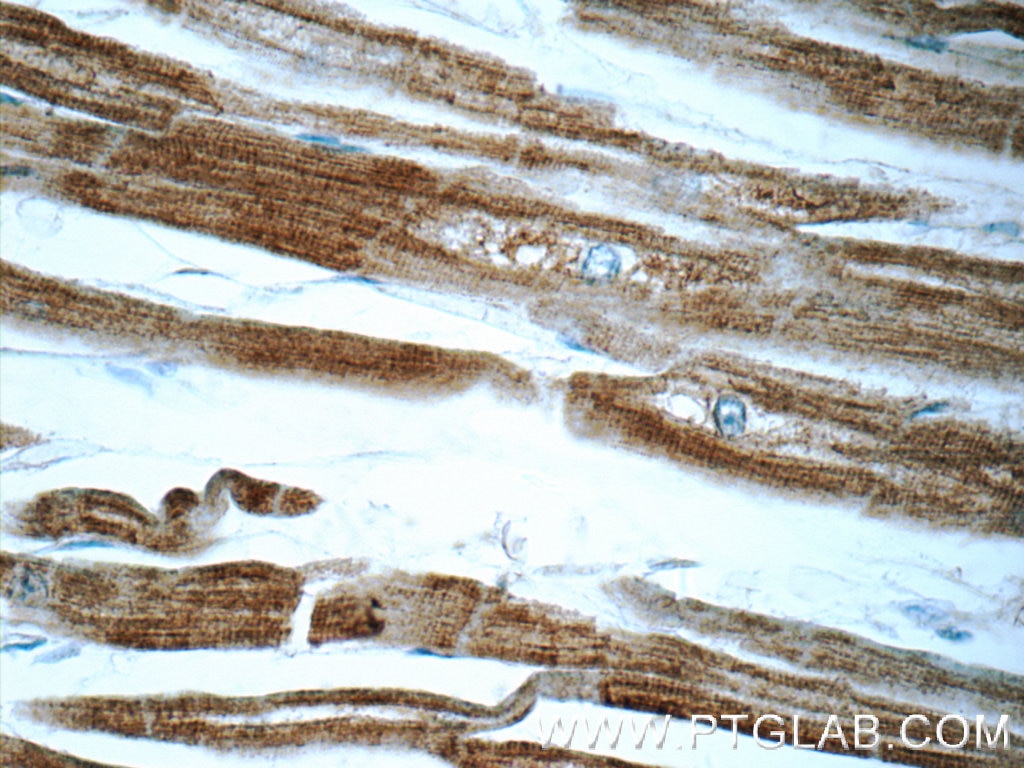 Immunohistochemistry (IHC) staining of human heart tissue using Septin 8 Polyclonal antibody (11769-1-AP)