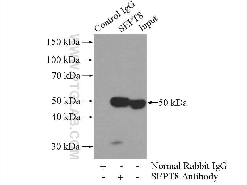 Immunoprecipitation (IP) experiment of HeLa cells using Septin 8 Polyclonal antibody (11769-1-AP)