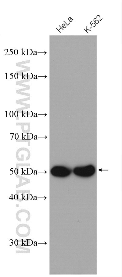 Western Blot (WB) analysis of HeLa cells using Septin 8 Polyclonal antibody (11769-1-AP)