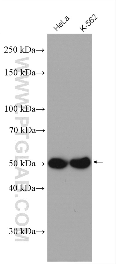 Western Blot (WB) analysis of HeLa cells using Septin 8 Polyclonal antibody (11769-1-AP)