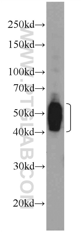 Western Blot (WB) analysis of rat brain tissue using Septin 8 Polyclonal antibody (11769-1-AP)