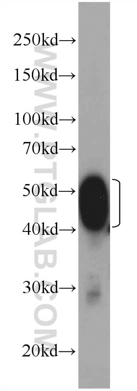 Western Blot (WB) analysis of mouse brain tissue using Septin 8 Polyclonal antibody (11769-1-AP)