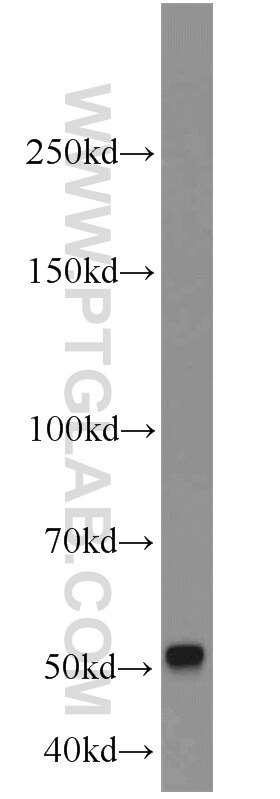 Western Blot (WB) analysis of mouse testis tissue using Septin 8 Polyclonal antibody (11769-1-AP)