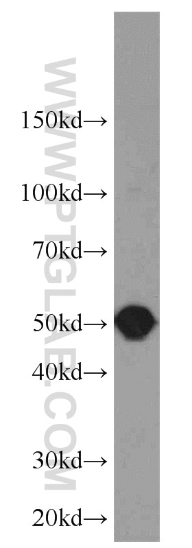 Western Blot (WB) analysis of K-562 cells using Septin 8 Polyclonal antibody (11769-1-AP)
