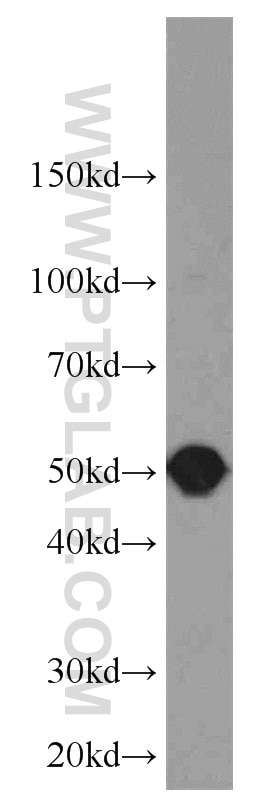 WB analysis of K-562 using 11769-1-AP