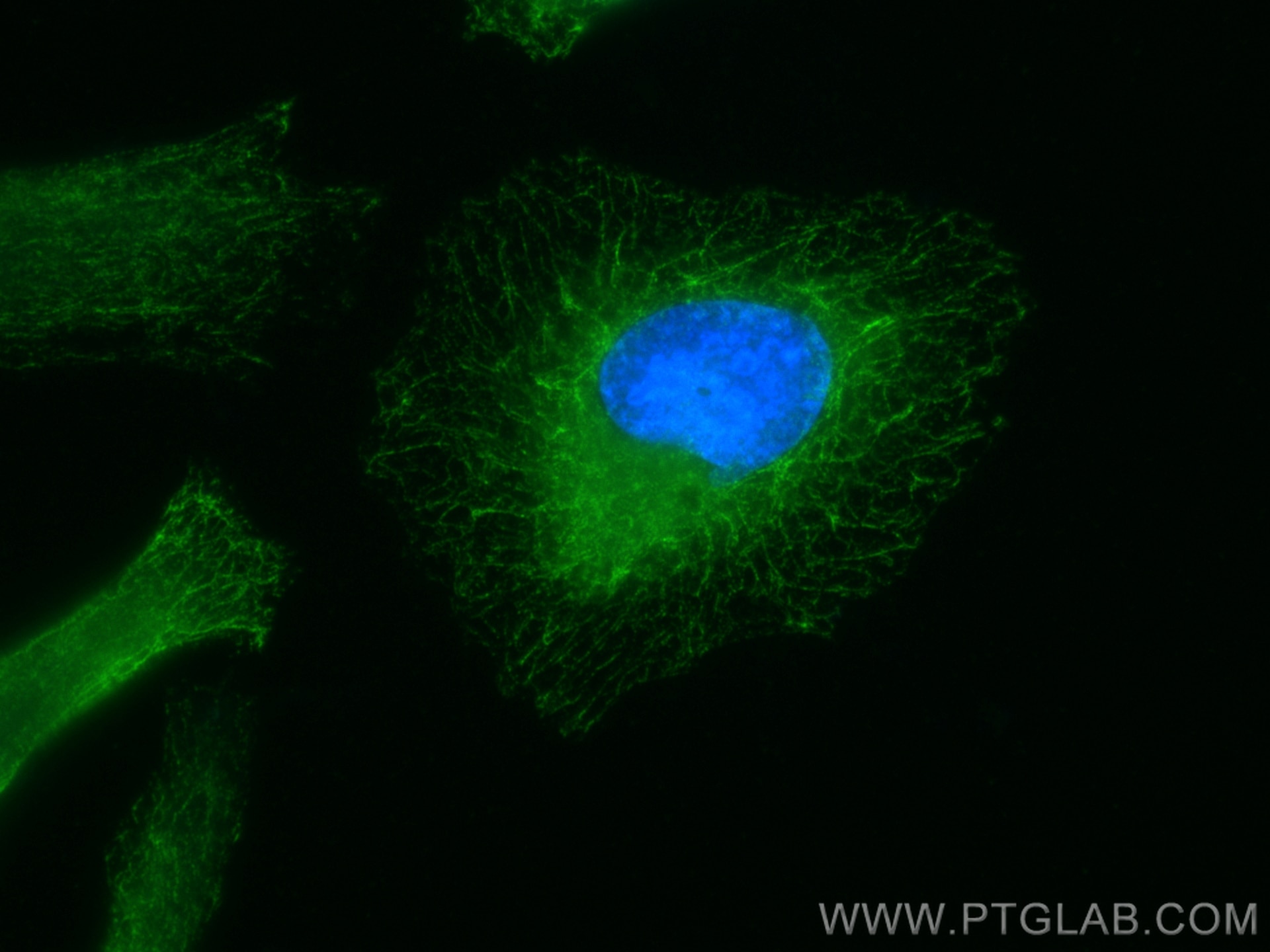 Immunofluorescence (IF) / fluorescent staining of HeLa cells using Septin 8 Monoclonal antibody (66188-1-Ig)