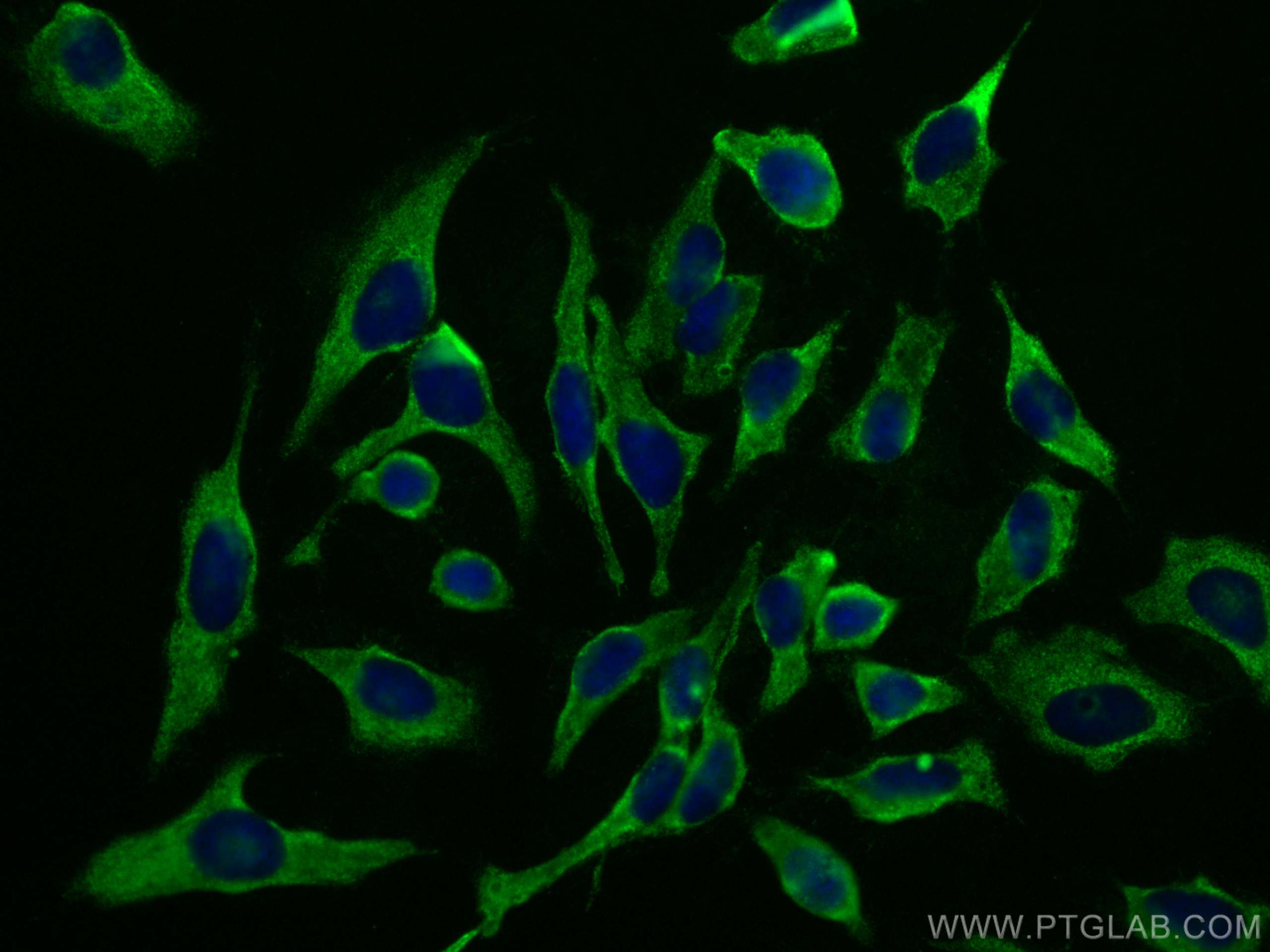 Immunofluorescence (IF) / fluorescent staining of HeLa cells using Septin 8 Monoclonal antibody (66188-1-Ig)