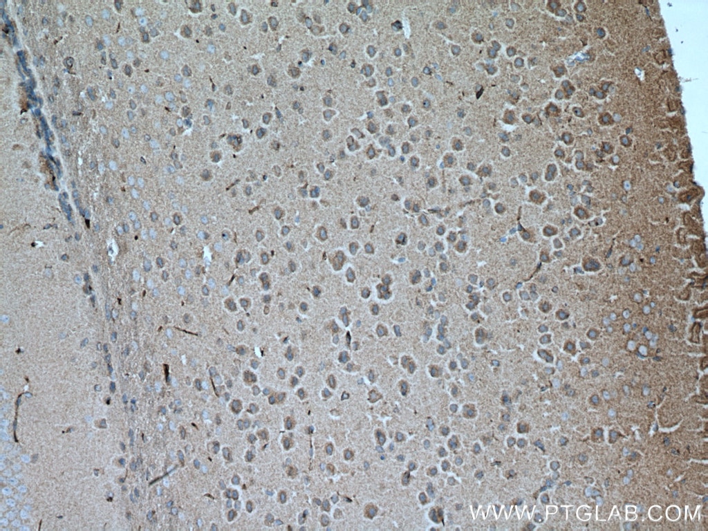 Immunohistochemistry (IHC) staining of mouse brain tissue using Septin 8 Monoclonal antibody (66188-1-Ig)