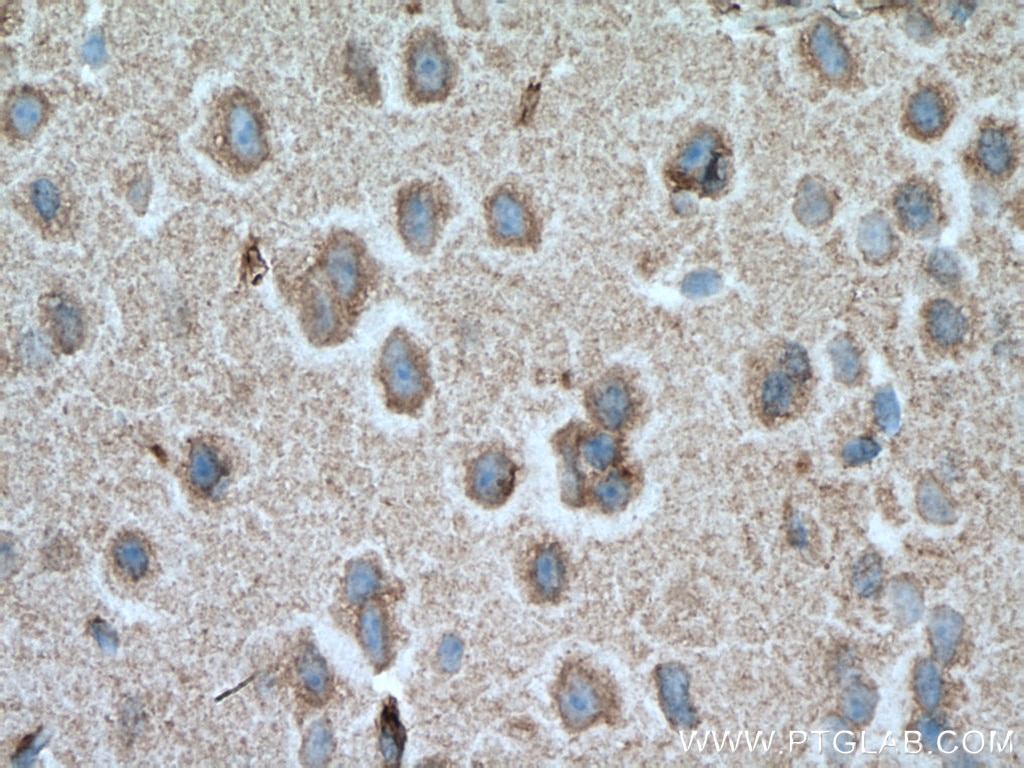 Immunohistochemistry (IHC) staining of mouse brain tissue using Septin 8 Monoclonal antibody (66188-1-Ig)