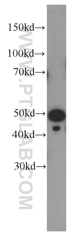 Western Blot (WB) analysis of HeLa cells using Septin 8 Monoclonal antibody (66188-1-Ig)