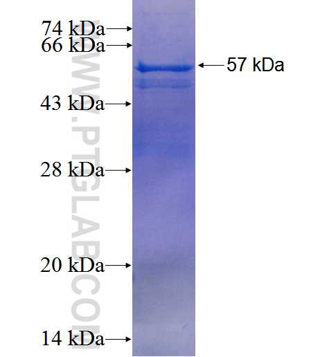 SEPT8 fusion protein Ag2357 SDS-PAGE