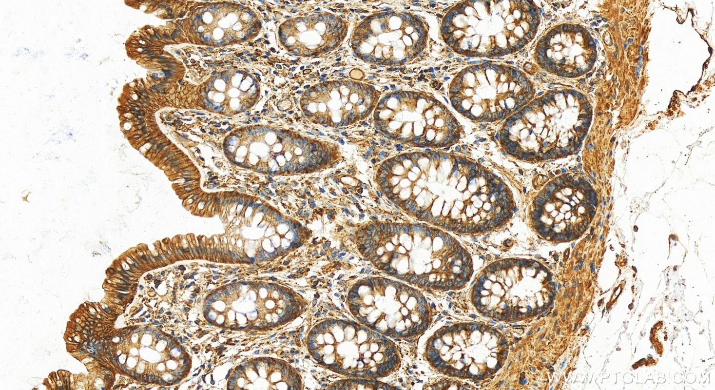 Immunohistochemistry (IHC) staining of human colon tissue using Septin 9 Polyclonal antibody (10769-1-AP)