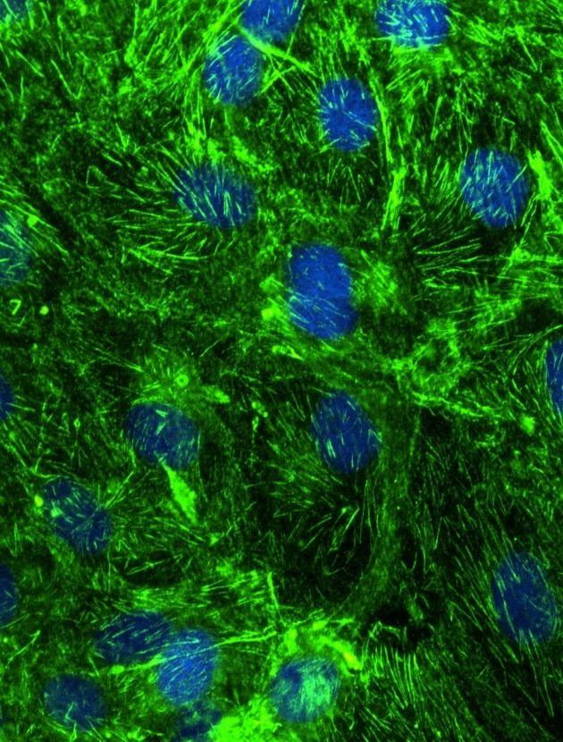 Immunofluorescence (IF) / fluorescent staining of hTERT-RPE cells using Septin 9 Polyclonal antibody (10769-1-AP)