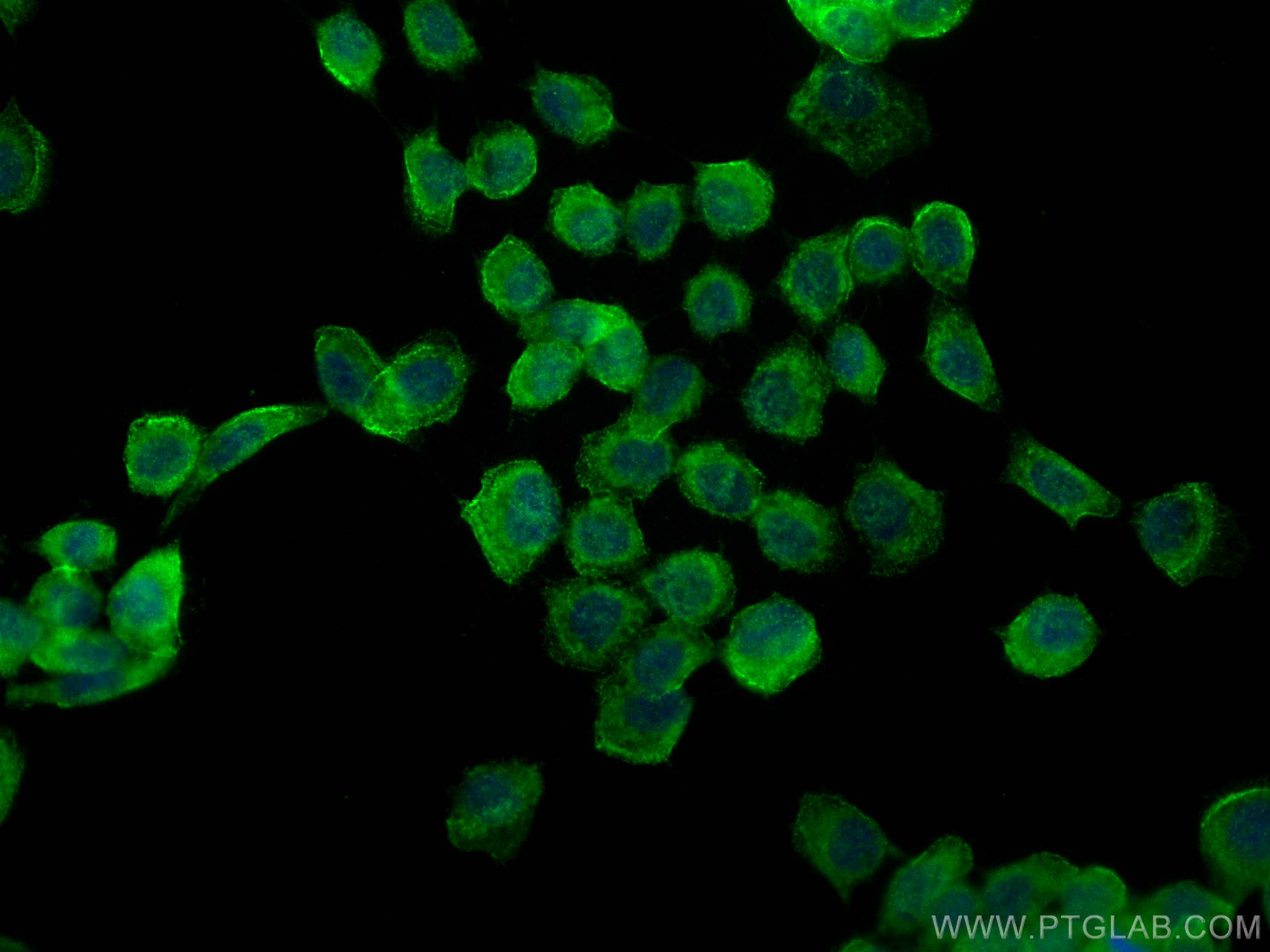 Immunofluorescence (IF) / fluorescent staining of A431 cells using Septin 9 Polyclonal antibody (10769-1-AP)