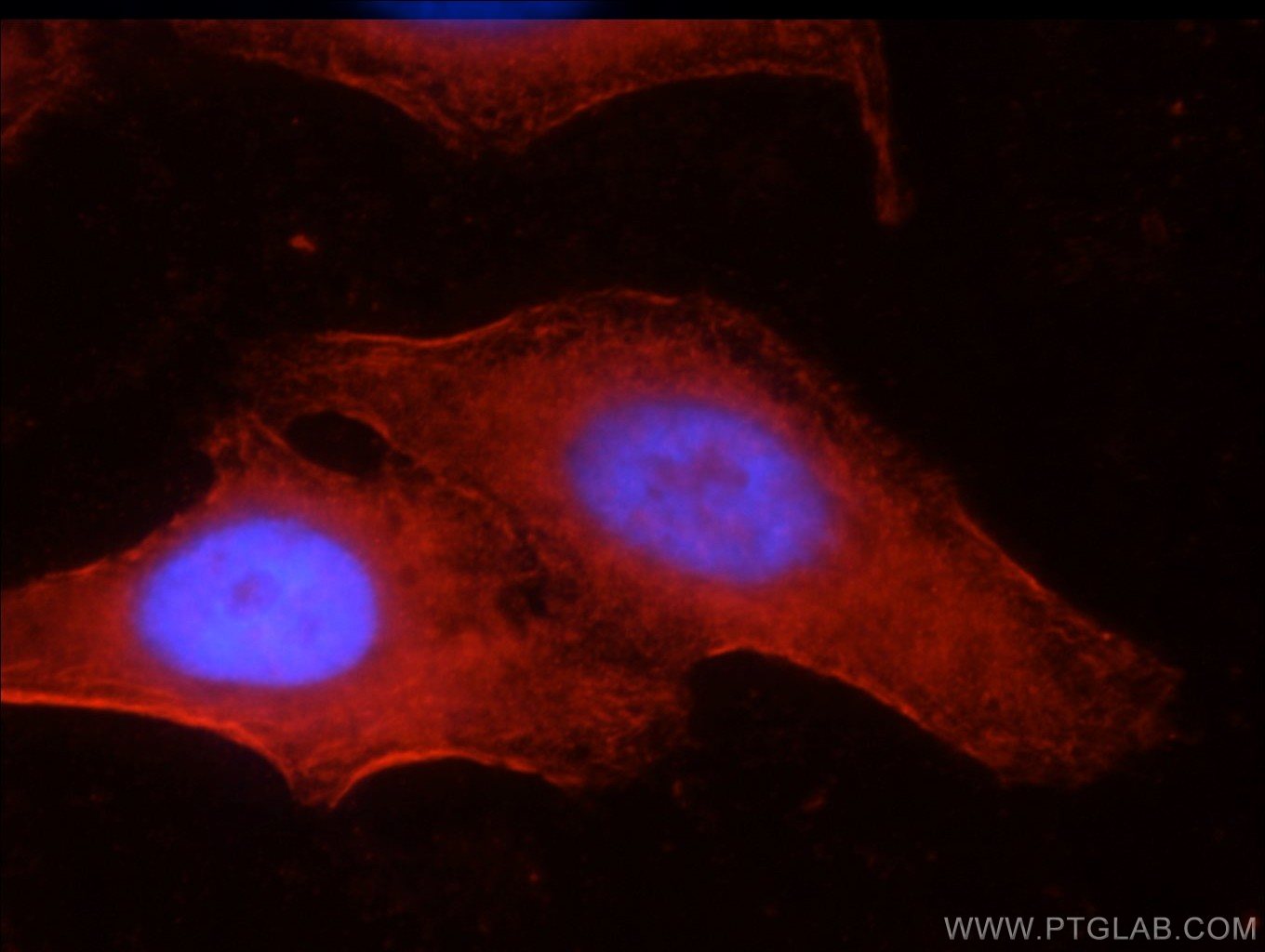 Immunofluorescence (IF) / fluorescent staining of HepG2 cells using Septin 9 Polyclonal antibody (10769-1-AP)