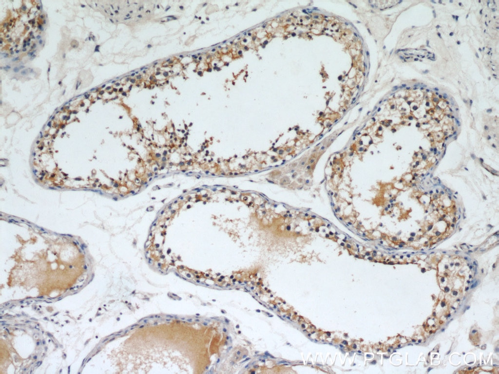 Immunohistochemistry (IHC) staining of human testis tissue using Septin 9 Polyclonal antibody (10769-1-AP)