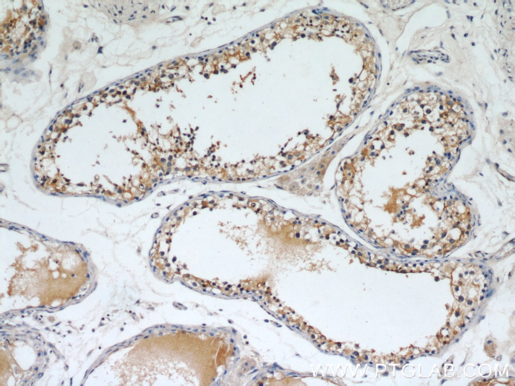 IHC staining of human testis using 10769-1-AP